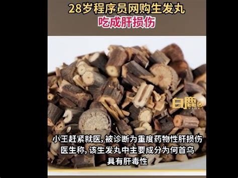 何首烏禁忌|何首乌致肝损害病例排中药首位，知晓5个用药禁忌可保命！